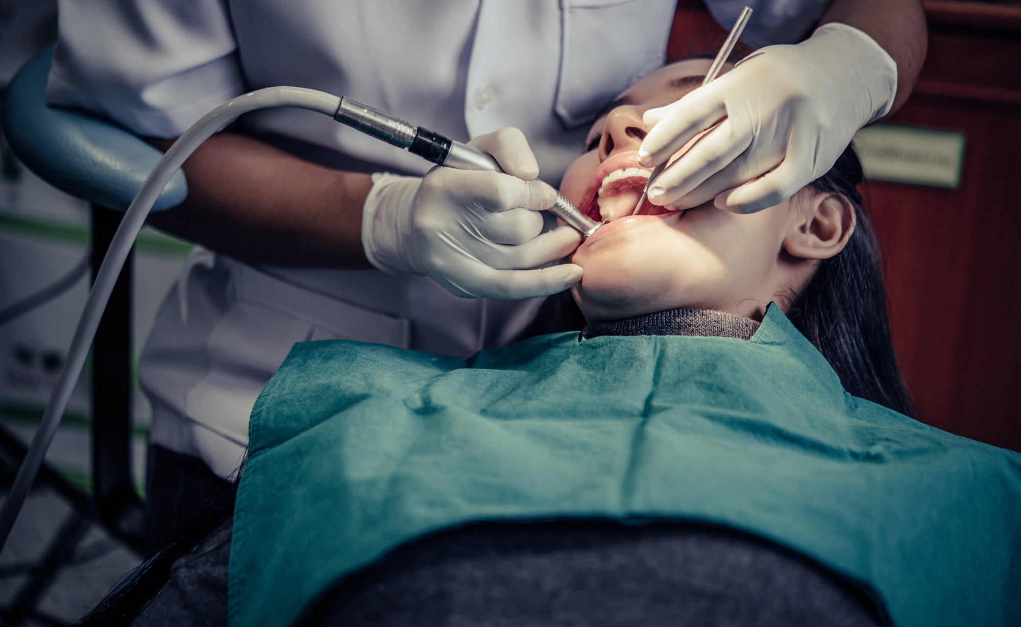 Can A Dentist Tell If You Vape?